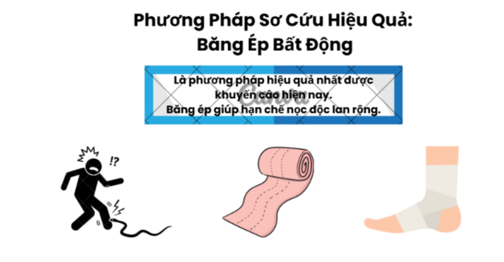 5. Phương pháp sơ cứu hiệu quả: Băng ép bất động